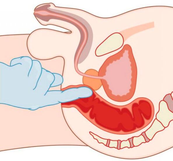 stimulation of the G-spot in a man through the anus